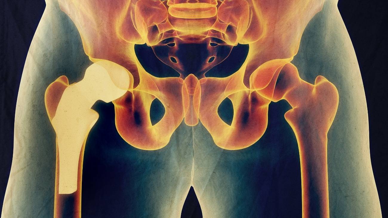 Hip joint anatomy