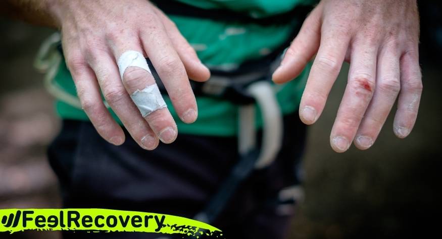 What are the most common types of hand, finger and wrist injuries when climbing?