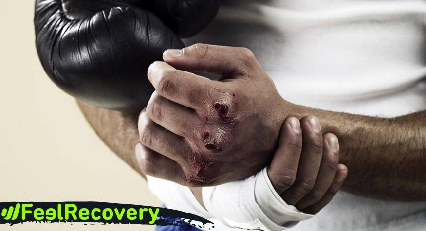 What are the most common types of injuries in contact sports such as boxing?