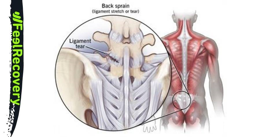 Ligaments and tendons of the back